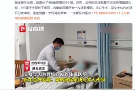 女子天生4个肾竟全部长结石，医生提醒图片