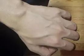 有人手臂“青筋暴起”，然而有人几乎看不到青筋，哪种更健康呢？图片