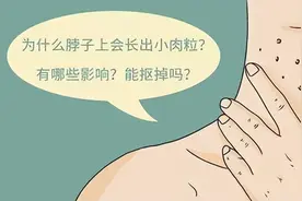 脖子、腋下长出的“小肉粒”是什么？能不能用手揪掉呢？早看早知图片