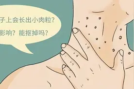 脖子、腋下长出的“小肉粒”是什么？能不能用手揪掉呢？早看早知图片