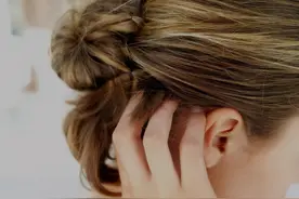 头上总是长出疙瘩和脓包，到底是咋回事？医生：可能和这7点有关图片