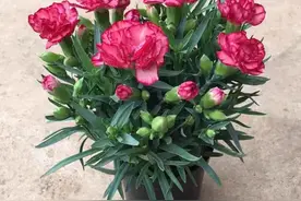 CT后发现自己只有一个肾图片