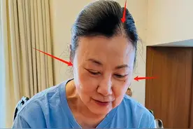 汪明荃近照曝光，面容蜡黄头发稀疏，77岁生日无儿女陪伴显落寞图片