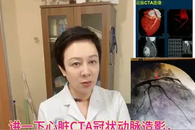 讲一下心脏CTA 及冠状动脉造影！避免重复检查！图片