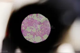 约了不明Pa，担心得性病，怎样自查及处理？付医生一次性全告诉你图片