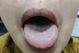 这两则典型案例，可以很好的锻炼辨证思维，来加入讨论吧图片