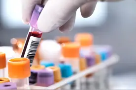 血液常规检查有何意义？图片