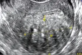 医院有黑幕？夫妻做试管婴儿，长大后竟然与父亲无血缘关系！图片