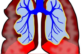 呼吸正常却已双肺损伤，老人“阳”后需警惕“沉默性低氧血症”图片