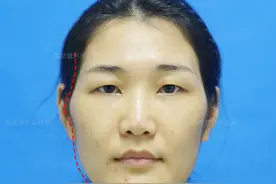 女生颧骨高就一定不好看吗？错，颧骨高也好看，不好看是颧骨高耸图片