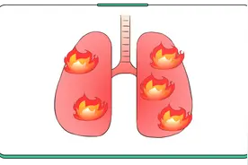 痰多吐不净黏糊糊、夹带血丝、黄浓痰，是病加重了？哪些要就医？图片