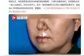 鼻子周围有这样的“黑头”就要小心了，它可能是皮肤癌！图片