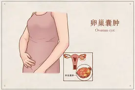 超声解读：卵巢囊肿到底需不需要手术图片