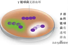 链球菌感染很常见，你至少需要知道这四点！图片