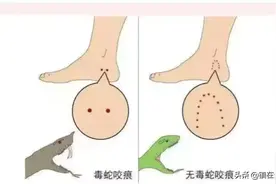 南安七旬老汉摘菜时被蛇咬伤图片