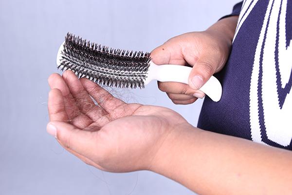 头发发痒掉头发怎么办