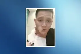 小小口腔溃疡为何变成癌？有这3个危险因素，离口腔癌仅一步之遥图片