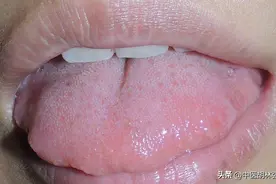 脾虚痰湿难调？这个奇方，一补一消，一方双效，深层病邪一扫光图片