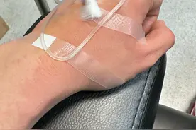 44岁黄晓明因病紧急入院，浑身起红疹挂吊针，自称不能太放纵自己图片