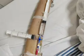 PICC导管被堵住的经历图片