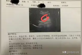 30岁的他工作6年查出胆囊息肉，经过半年自救后，他体会真的很深图片