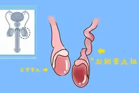 少年“蛋蛋”扭转严重，康雅医院开通绿色通道成功救治图片