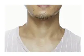 为什么有的男的没有喉结？图片