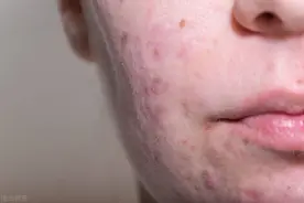 这8种成分，会让您的皮肤越用越差，想要好皮肤的，一定要远离它图片