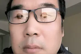 10年重度干眼症的恢复经历，我当时也不敢相信图片
