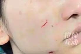 狗主人回应边牧咬人：未经允许摸狗图片