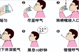 如何使用气雾吸入剂，这些操作细节你应该要知道图片
