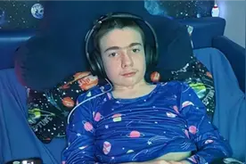 全球首例，英国男孩颅内植入设备控制癫痫发作图片