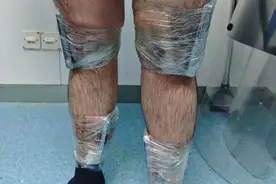 2人将82台旧手机绑在身体走私进境，被海关查获图片