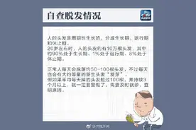 未老先秃？年轻人脱发的四大原因图片