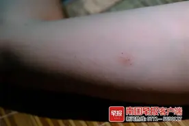 头皮发麻！南宁一男子被红火蚁咬伤多处，水泥墙也被啃食图片