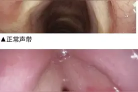 教师节快乐！送您一份护嗓宝典图片