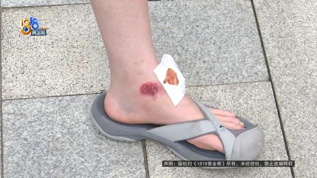 女子骑车被外卖小哥撞伤，本想私了要求赔三百医药费，外卖小哥：我只有三块钱