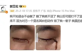 郭艾伦训练时被队友戳伤眼部，责任应当如何判定？图片
