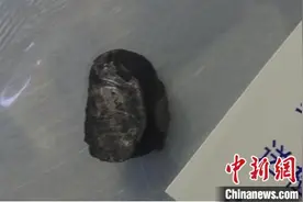 金属铁块击中颈部大动脉 医生紧急救治挽回患者生命图片