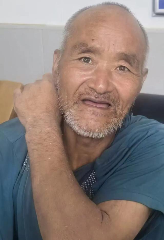 黑砖厂残障工人干不好被电钻刺胳膊
