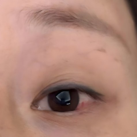 粉色“子弹”飞过来，我的左眼什么都看不清了