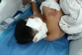 湖南邵阳被狗咬伤男童已出ICU：肇事狗是养了3年的阿拉斯加，主人已赔2万元图片