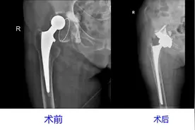 看骨伤不必舍近求远，这里守护患者“稳稳的幸福”图片