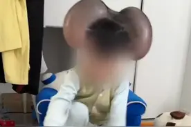 3岁男童拿掉头上巨痣，妈妈：孩子曾被取笑像“米老鼠”，我们是擦干泪往前走的图片