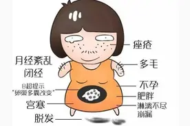 得了多囊卵巢综合症怎么办？松江医生提醒→丨健康智慧屋图片