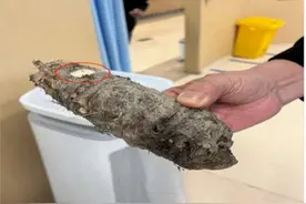 舔一口差点住进ICU！温州一女子错把滴水观音当芋头图片