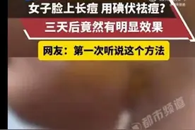 涂抹碘伏祛痘3天就见效？惊呆女大学生！皮肤科专家：可以但没必要图片