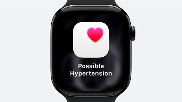 史上最大屏最长续航 Apple Watch 来了，还能测高血压风险