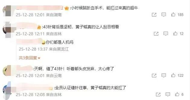 冲上热搜！黄子韬因脑淤血接受开颅手术缝了43针，本人回应