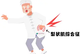 臀腿疼痛就是腰间盘突出了？也可能是梨状肌惹的祸！图片